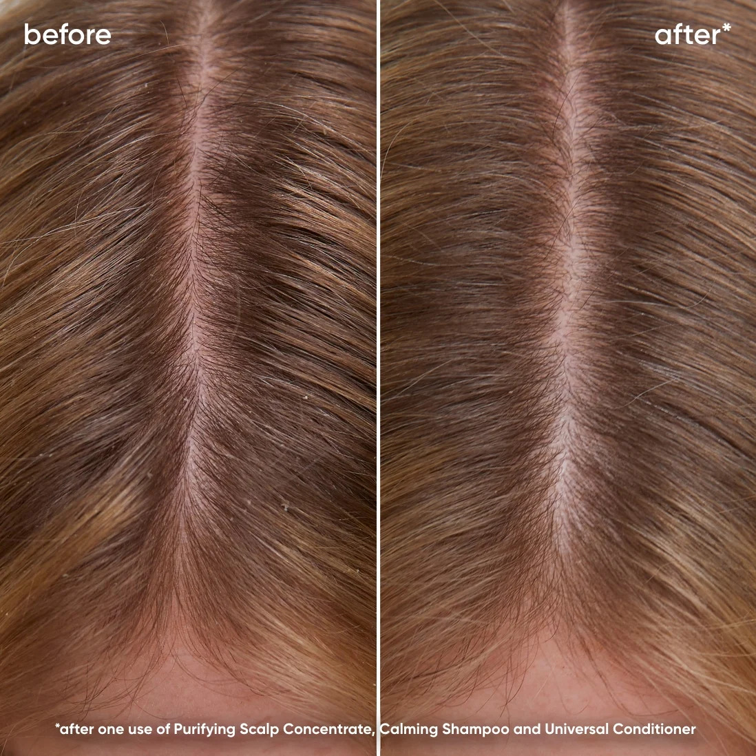 Scalp-Sync-Calming-Shampoo-before-after-thumbnail-ezgif.com-webp-to-jpg-converter