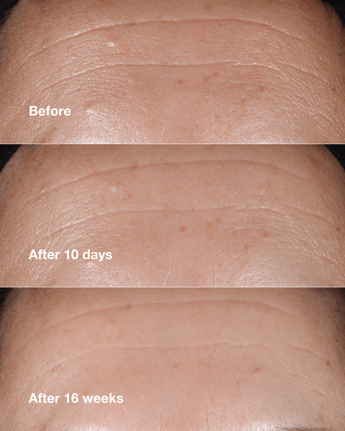 cl_prod_87057_1200x1500_0