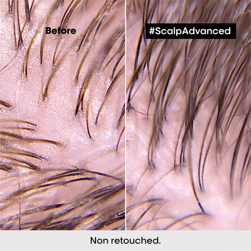 L'Оreal Professionnel Scalp Advanced Anti-Oiliness шампон прочистување на скалпот, против маснотии 300мл 14