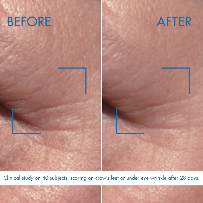 Biotherm Blue Therapy Pro-Retinol крема за околу очи за сите типови кожа 15мл 15 Biotherm Blue Therapy Pro-Retinol крема за околу очи за сите типови кожа 15мл 14