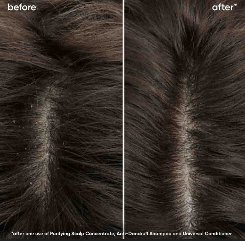 Biolage Scalp Sync лесен регенератор за сув, чувствителен, масен и/или скалп склон кон првут 280мл 2