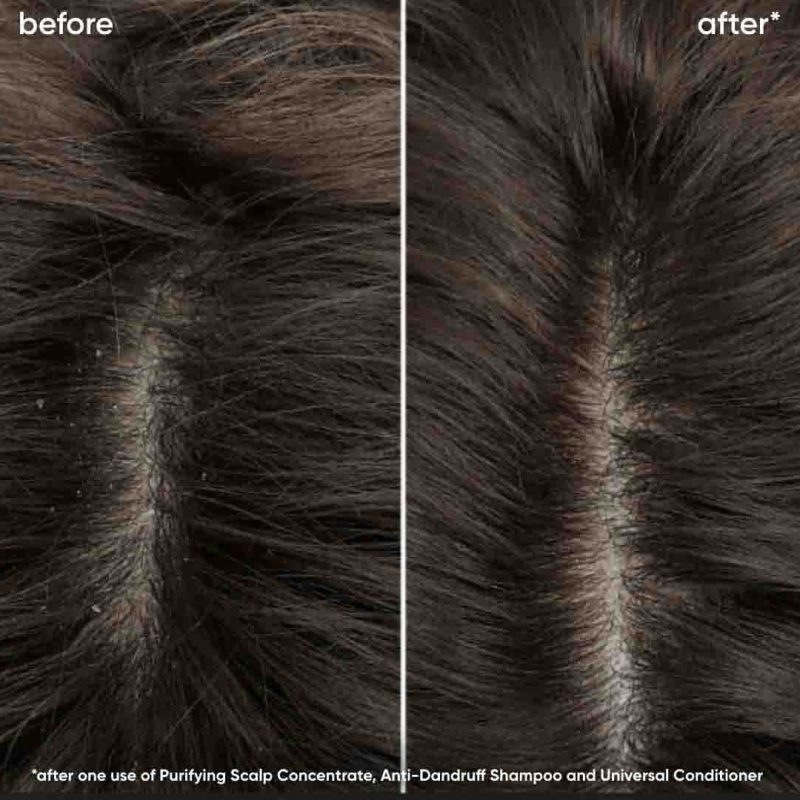 Biolage Scalp Sync лесен регенератор за сув, чувствителен, масен и/или скалп склон кон првут 280мл - Image 2