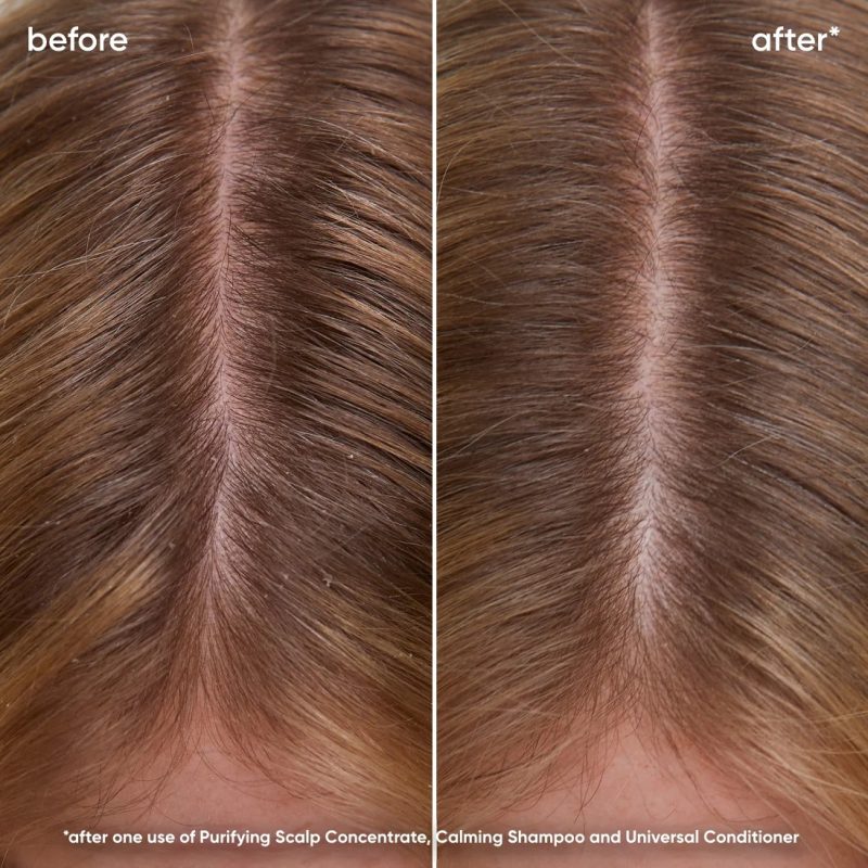 Biolage Scalp Sync смирувачки шампон за иритиран и чувствителен скалп 250мл 2