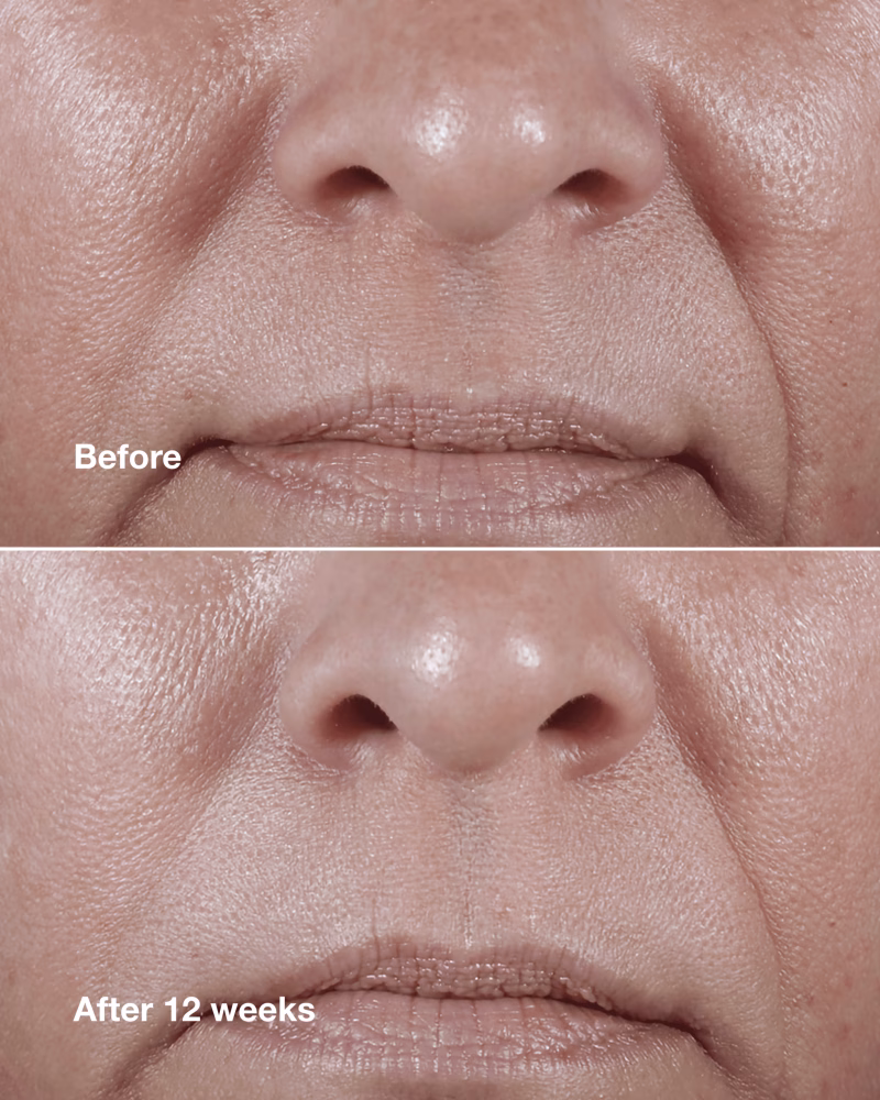 Clinique Smart Clinical Repair™ Wrinkle Correcting Rich Cream крема против брчки за многу сува до сува кожа и комбинирана кожа 50мл 2