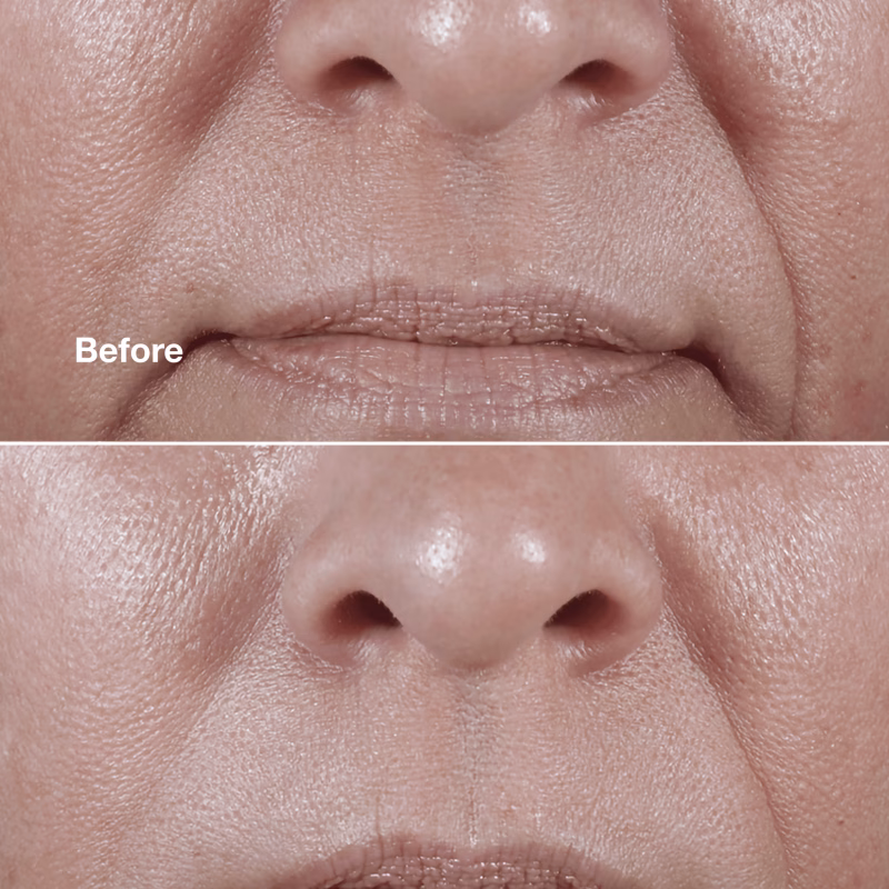 Clinique Smart Clinical Repair™ Wrinkle Correcting Rich Cream крема против брчки за многу сува до сува кожа и комбинирана кожа 50мл - Image 2