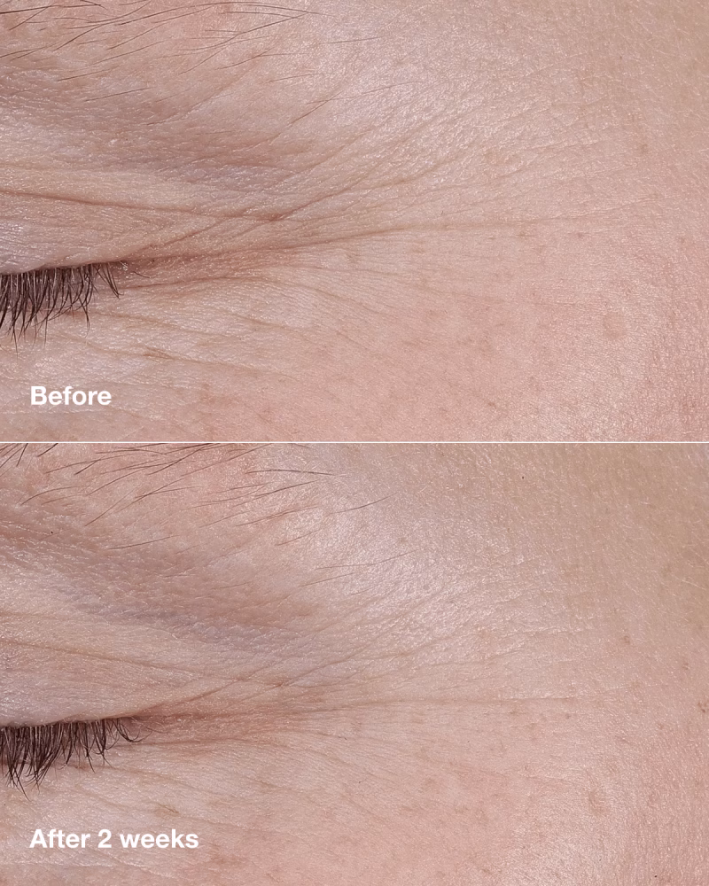Clinique Smart Clinical Repair™ AM/PM Retinoid Balm ретиноиден балсам против брчки за сите типови кожа 3гр. 5 Clinique Smart Clinical Repair™ AM/PM Retinoid Balm ретиноиден балсам против брчки за сите типови кожа 3гр. 4