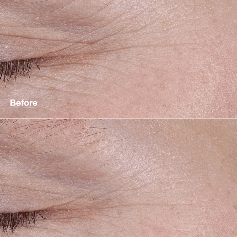 Clinique Smart Clinical Repair™ AM/PM Retinoid Balm ретиноиден балсам против брчки за сите типови кожа 3гр. 16 Clinique Smart Clinical Repair™ AM/PM Retinoid Balm ретиноиден балсам против брчки за сите типови кожа 3гр. - Image 3