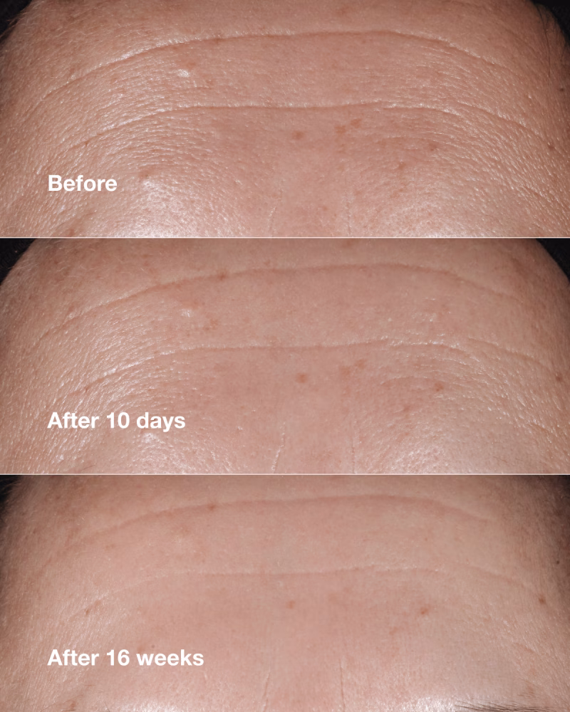 Clinique Smart Clinical Repair™ серум за корекција на линиите и брчките 2
