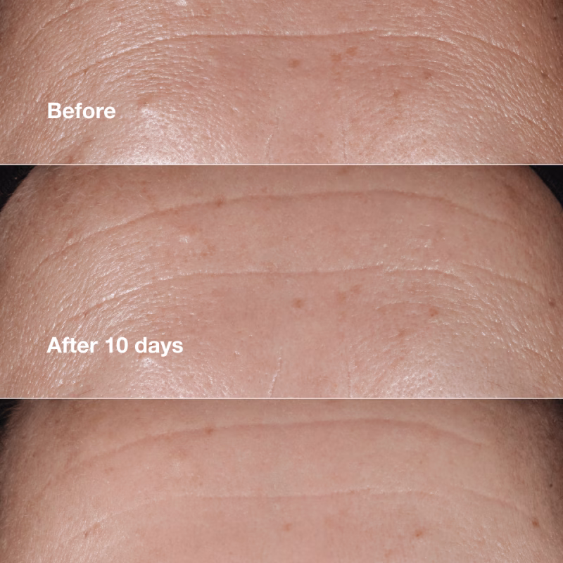 Clinique Smart Clinical Repair™ серум за корекција на линиите и брчките - Image 2