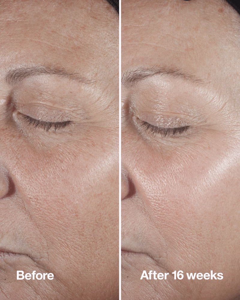 Clinique Smart Clinical Repair™ серум за корекција на линиите и брчките 4