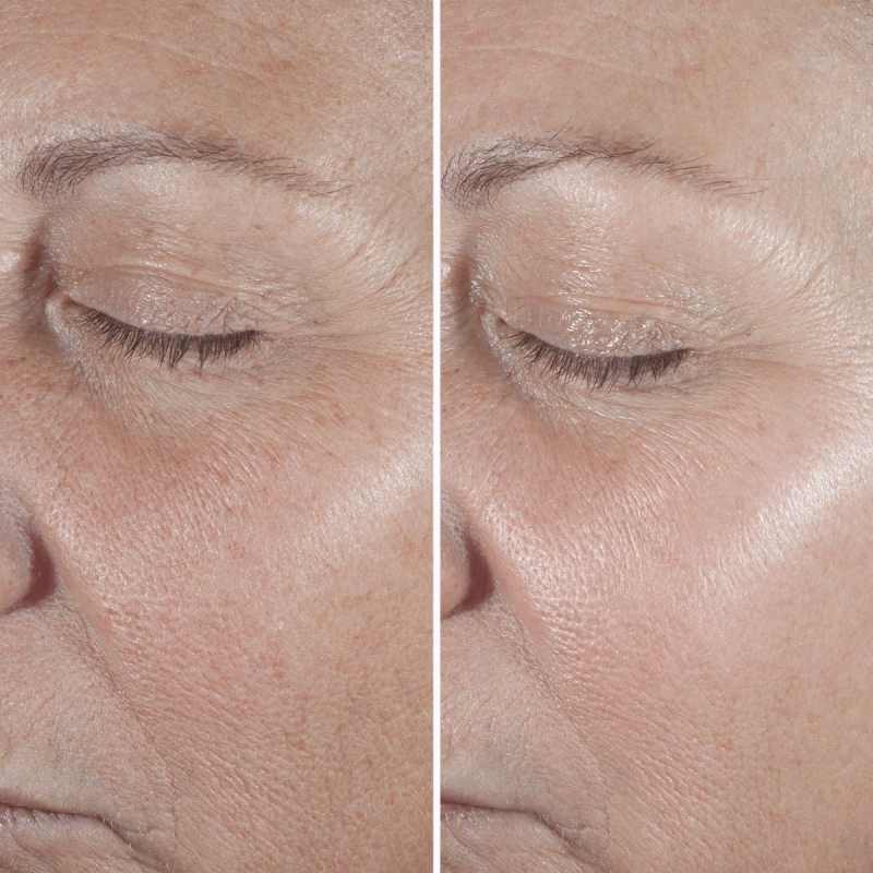 Clinique Smart Clinical Repair™ серум за корекција на линиите и брчките - Image 3