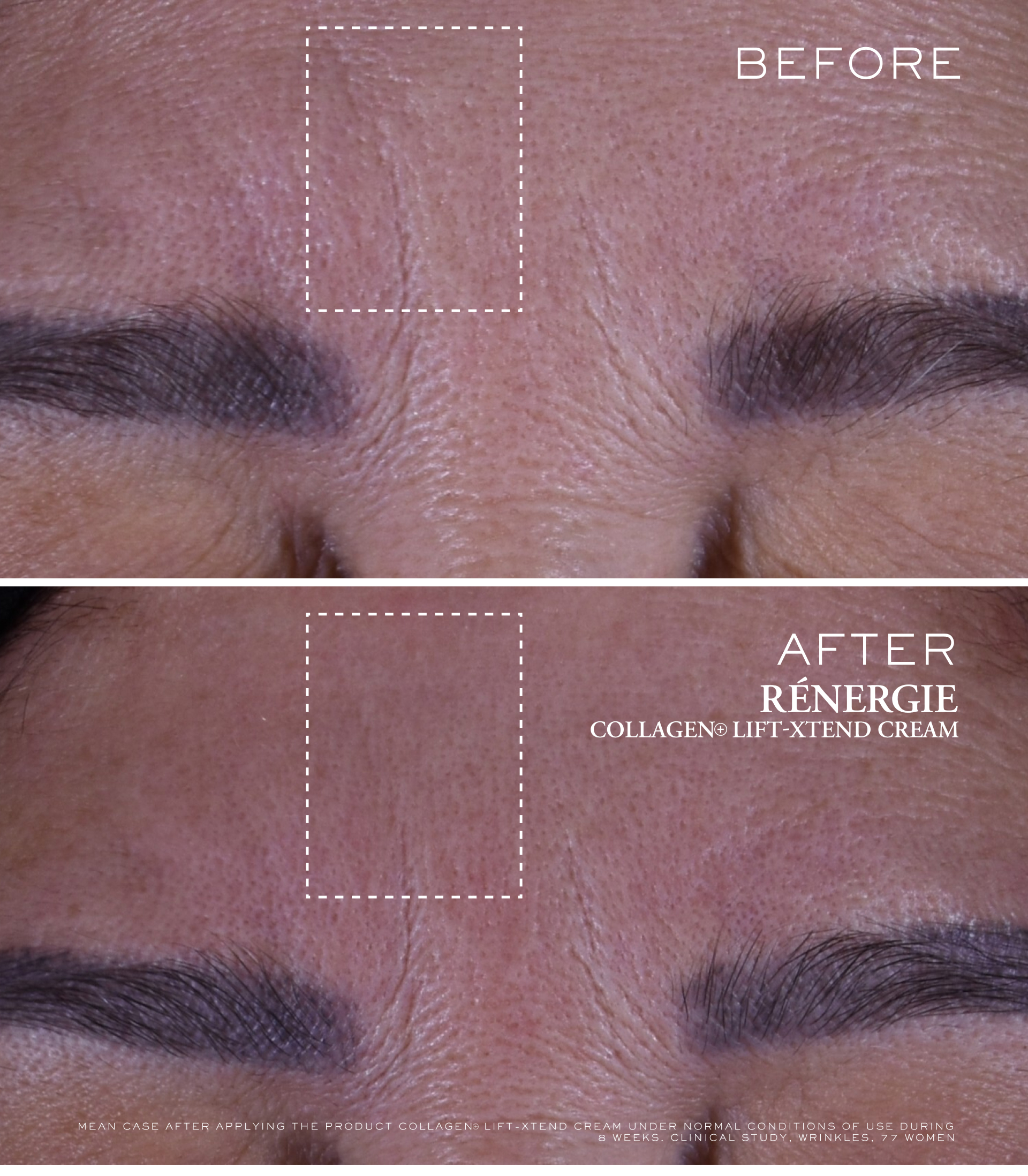 Lan_dmi_skin_renergie_collagen_BEFORE_AFTER COLLAGEN CREAM