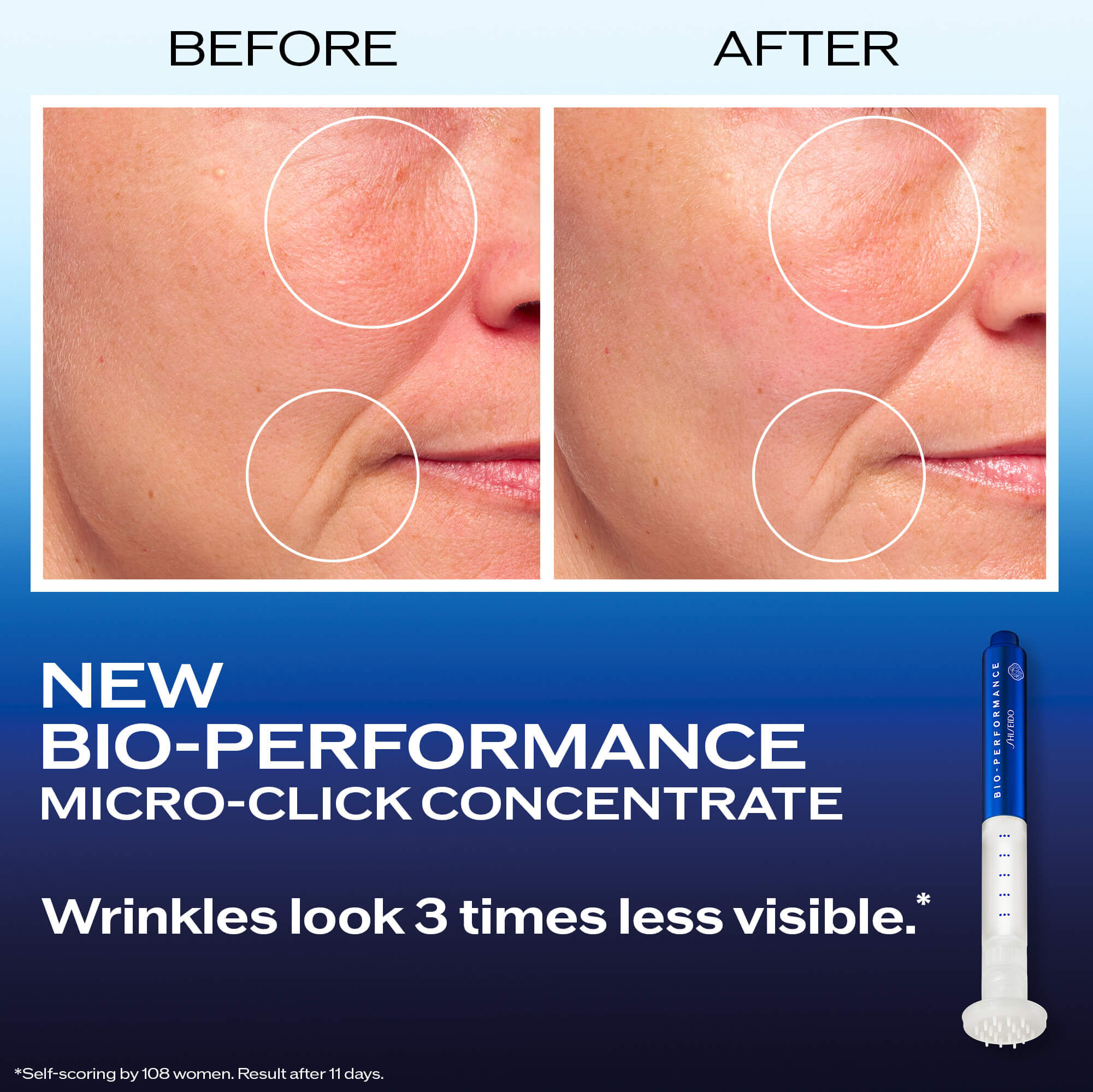 UK_BOP_Microneedle_alt1