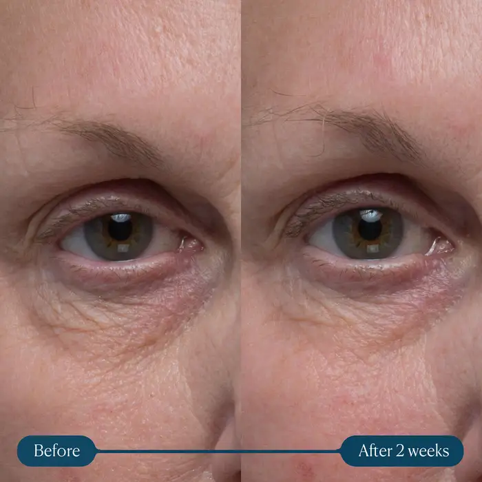 Elemis Pro-Collagen Vitality Eye Cream 15ml 6