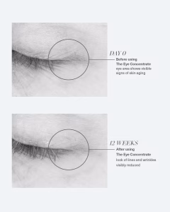 La Mer The Eye Concentrate концентриран третман за намалување на темните кругови и фини линии околу очите 15ml 16 La Mer The Eye Concentrate концентриран третман за намалување на темните кругови и фини линии околу очите 15ml 15